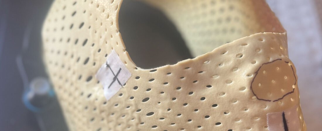 What My Radiation Mask Taught Me About Fear, Focus, and Mental Discipline