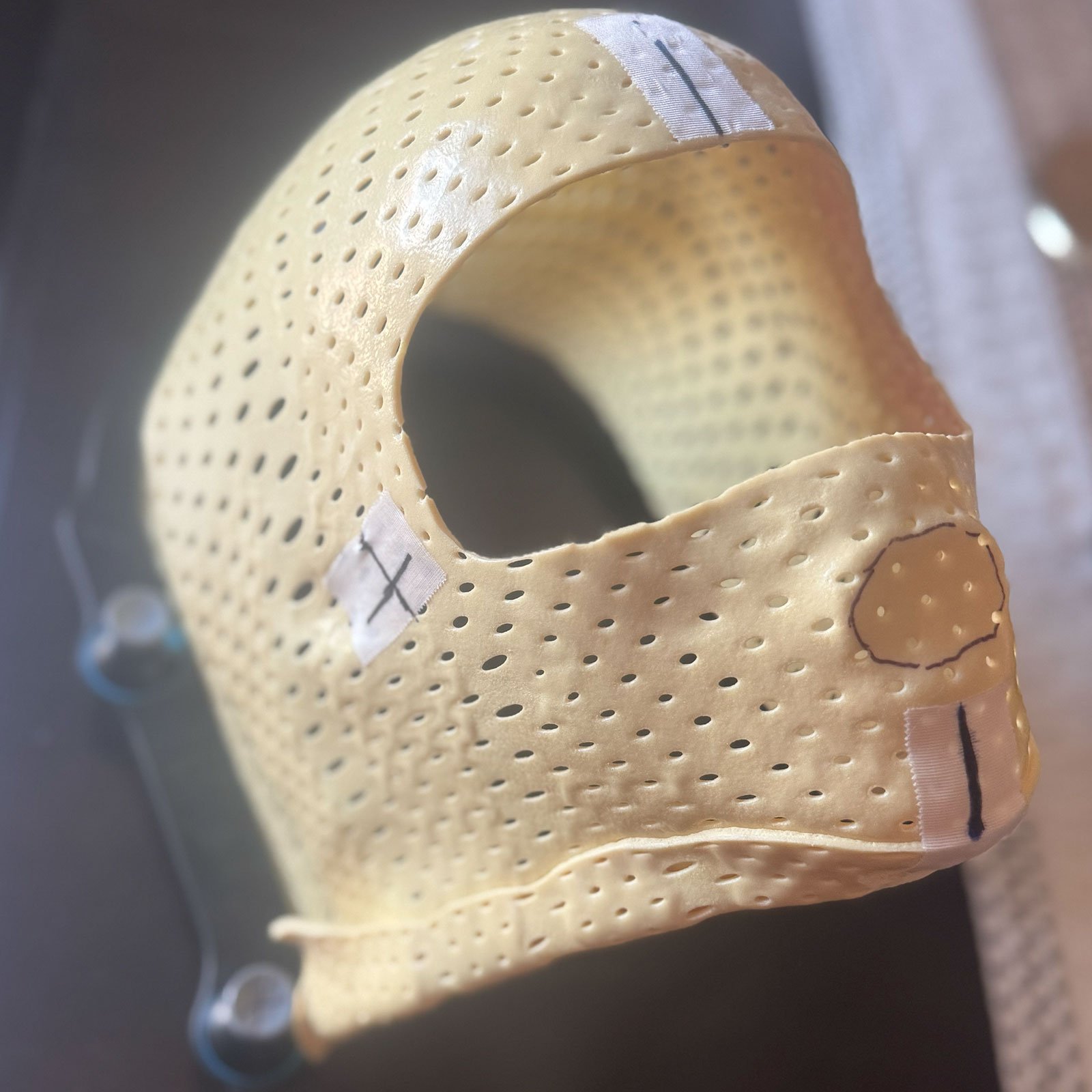 What My Radiation Mask Taught Me About Fear, Focus, and Mental Discipline
